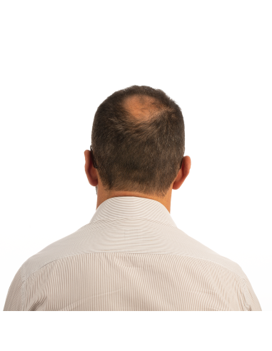 Fibres densifiantes GORDON pour clairsemés et calvitie Cheveux Gris