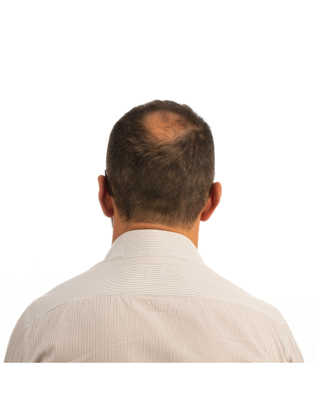 Fibres densifiantes GORDON pour clairsemés et calvitie Cheveux Chatain Foncé